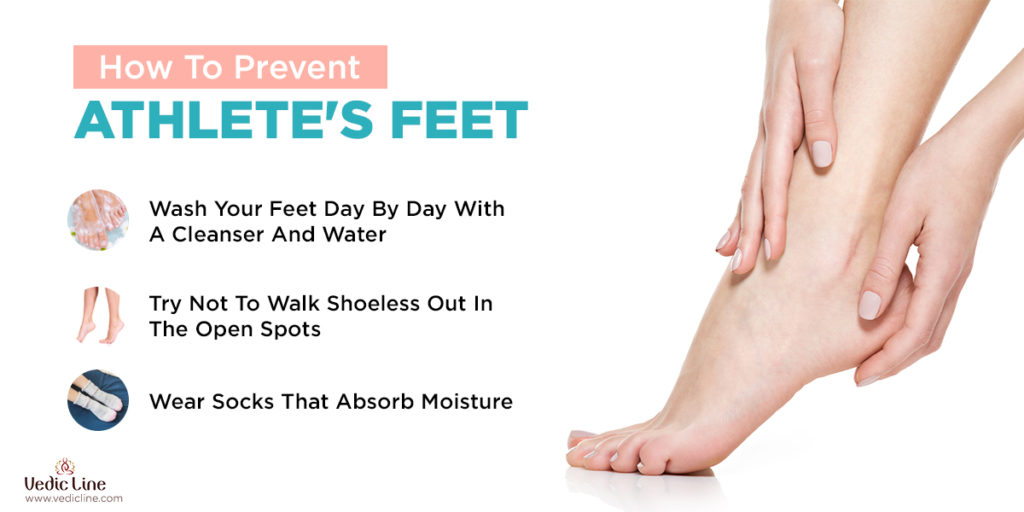 How to prevent athelet's feet-Vedicline