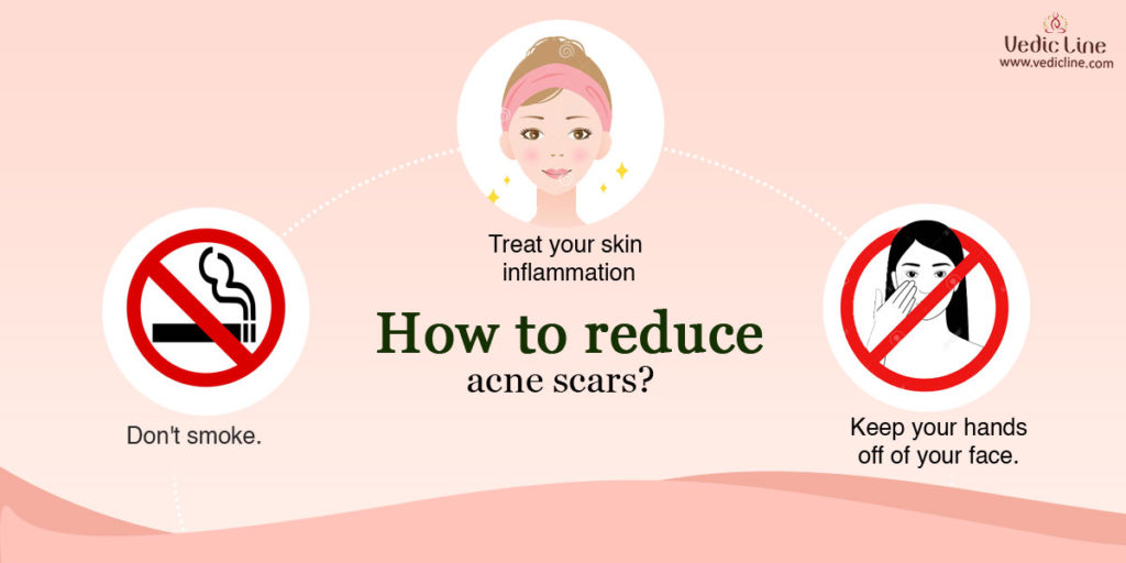 How to reduce acne and scars-Vedicline
