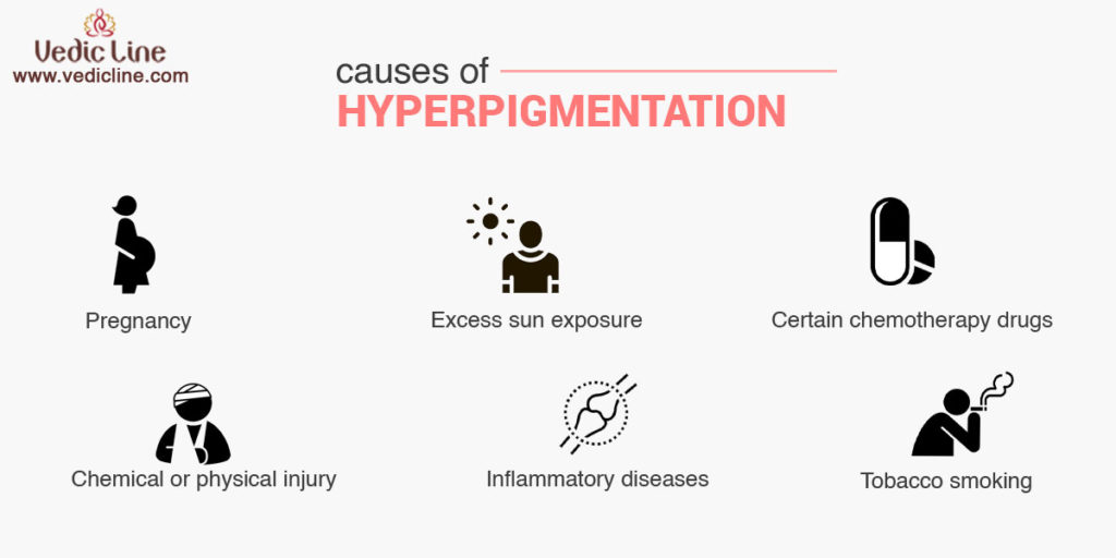 Causes of hyperpigmentation