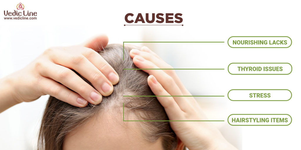 Causes of hair fall-Vedicline