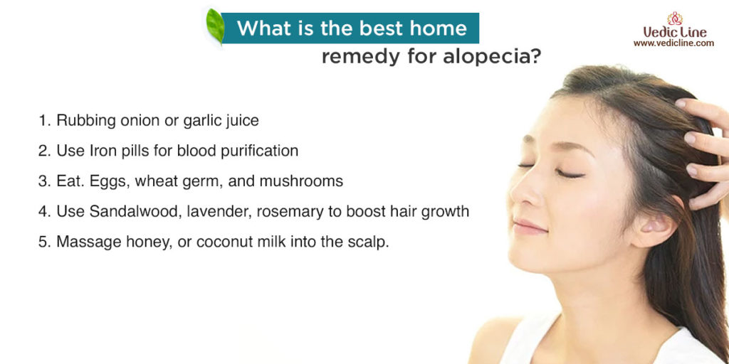 what is the best home remedy for alopecia ?