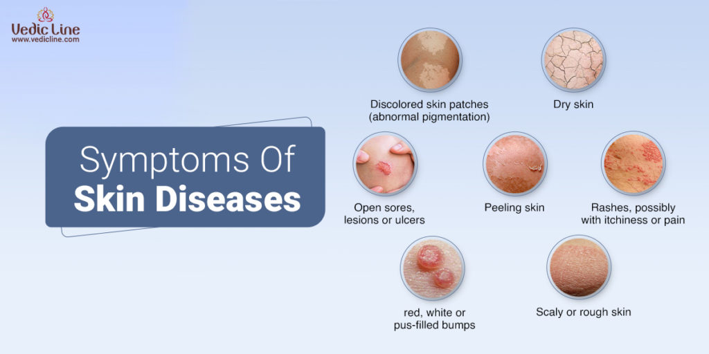 Symptoms of skin diseases