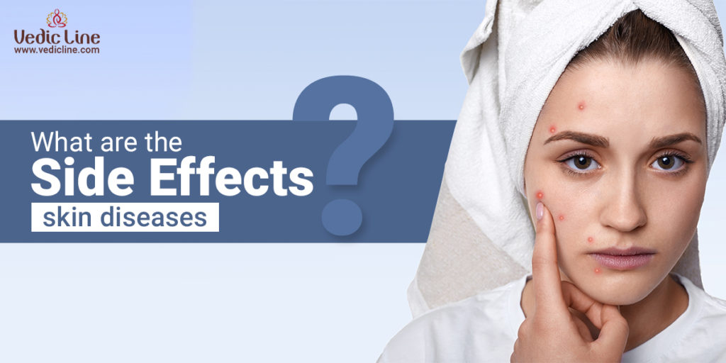 what are the side effects skin diseases ?