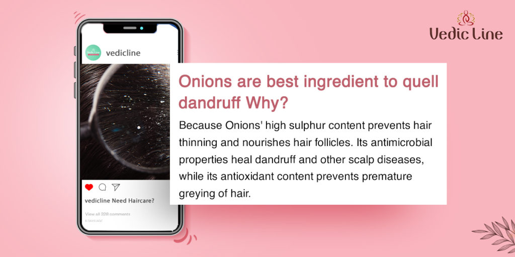 onions for dandruff